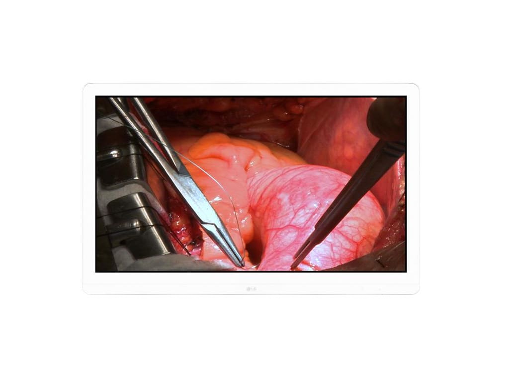 LG 27HJ713S-W 27-inch Surgical Monitor (White)