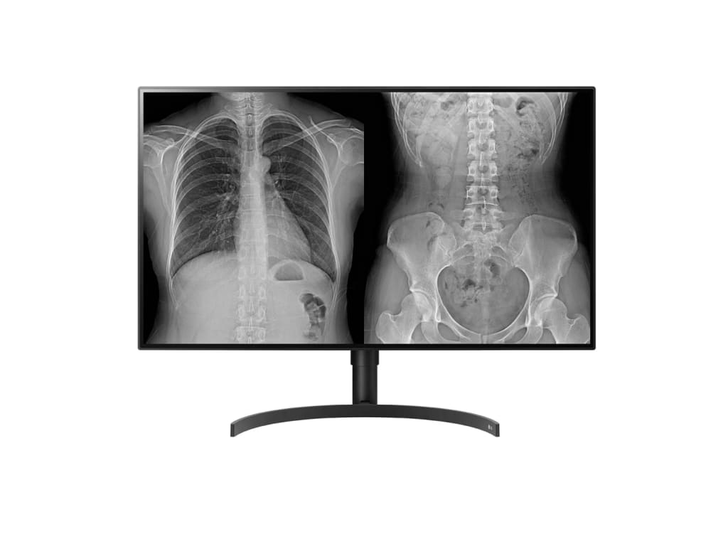 LG 32HL512D-B 31.5'' 8MP 4K Nano IPS Color Diagnostic Monitor