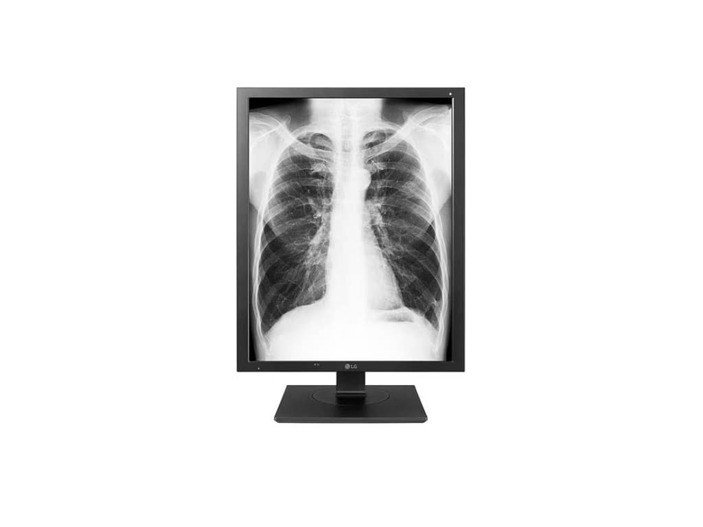 LG 21HK512D-B 21.3'' Diagnostic Monitor