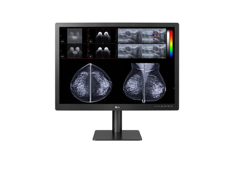 LG 31HN713D-B 31-inch Diagnostic Monitor