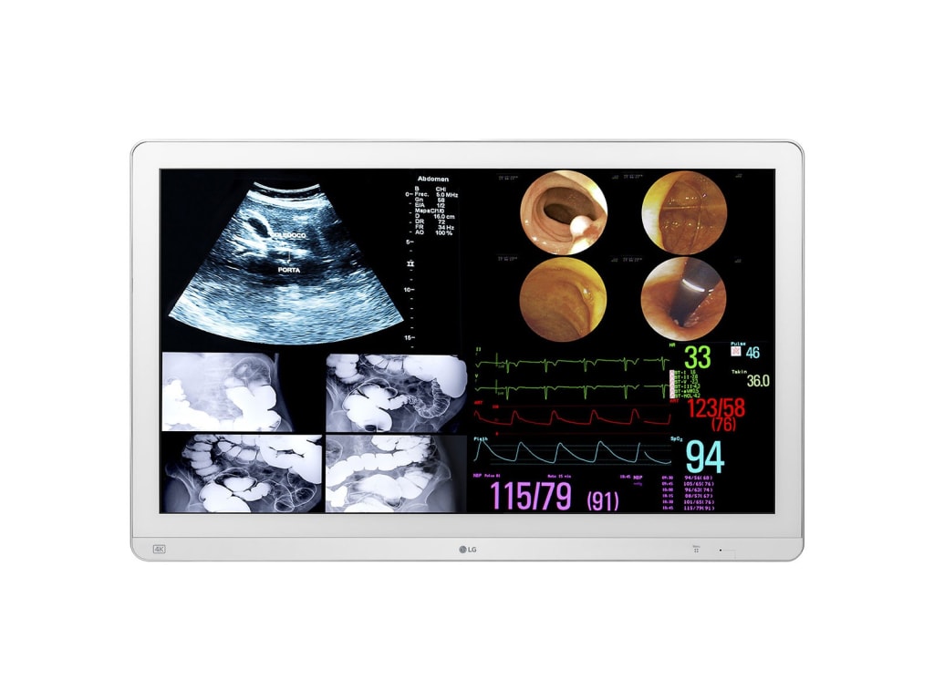 LG 32HL714S-W - 31.5'' Surgical Applications Monitor